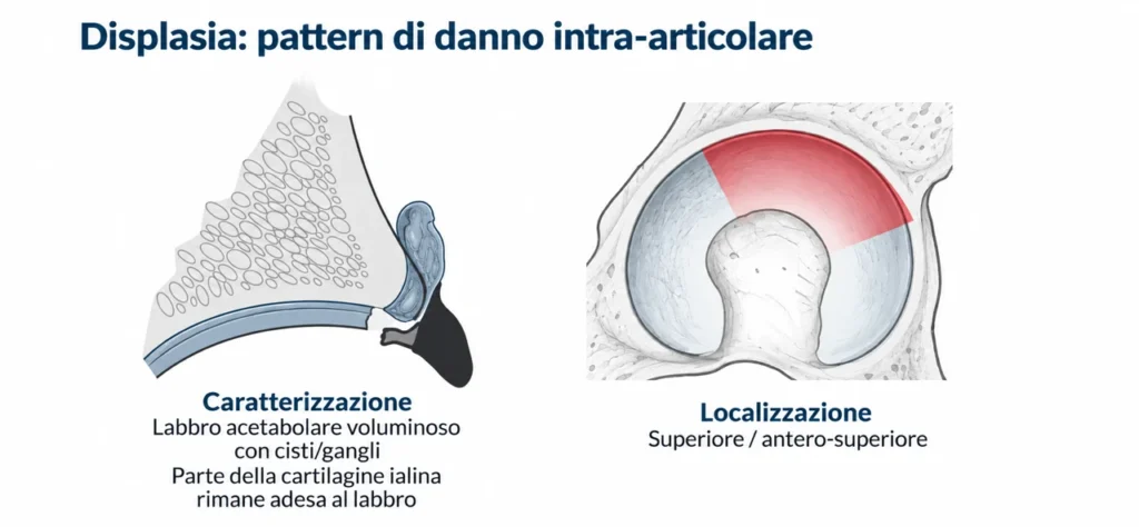 danno intra-articolare